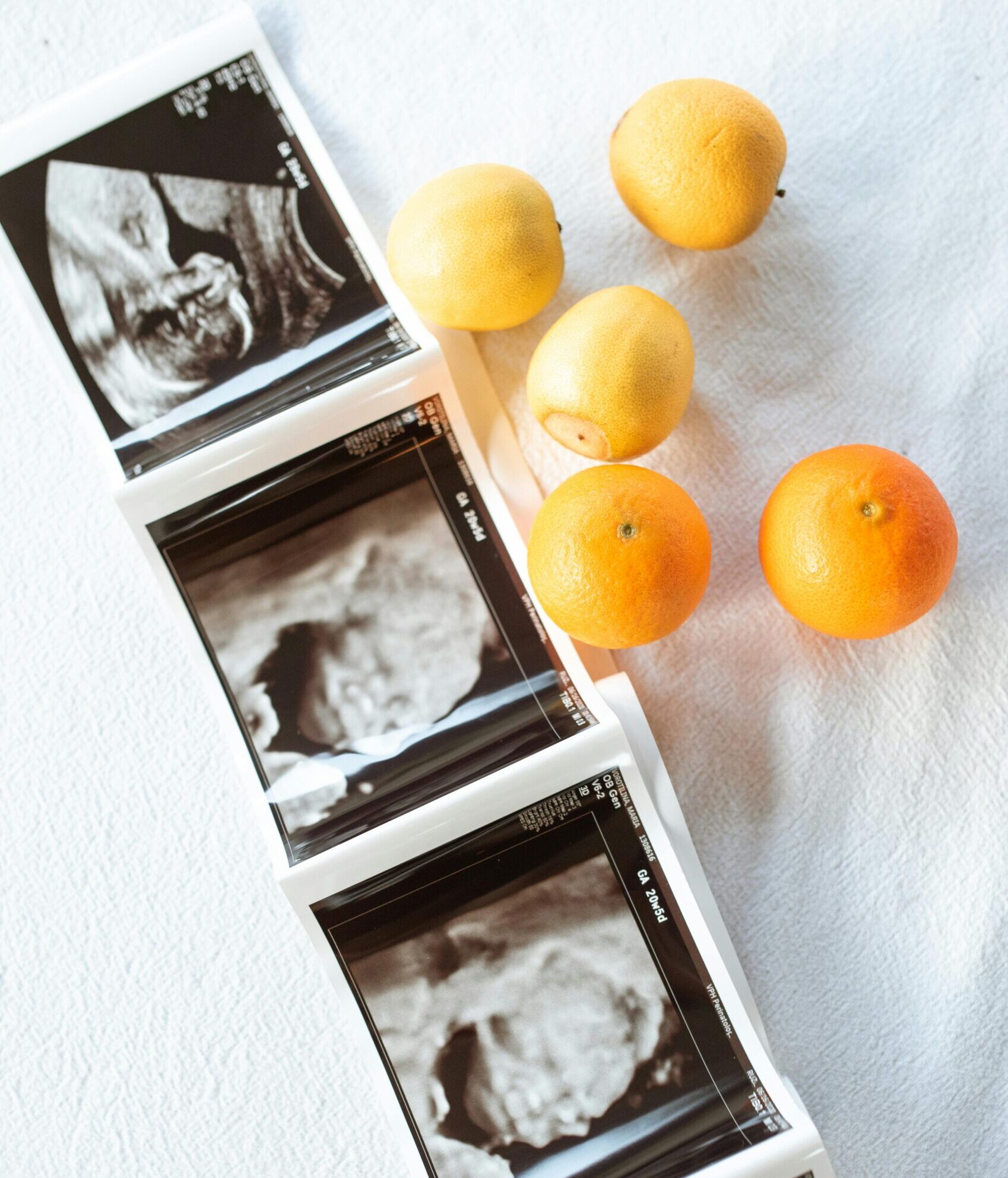 Ultrasound images paired with lemons and oranges on white fabric.